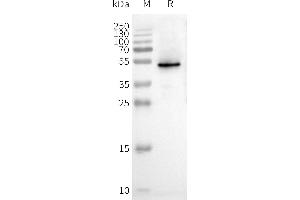 WB analysis of Human C-Nanodisc with anti-Flag monoclonal antibody at 1/5000 dilution, followed by Goat Anti-Rabbit IgG HRP at 1/5000 dilution (CXCR3 Protein)