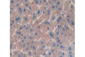 Used in DAB staining on fromalin fixed paraffin- embedded Kidney tissue (Complement Factor I antibody  (AA 358-603))