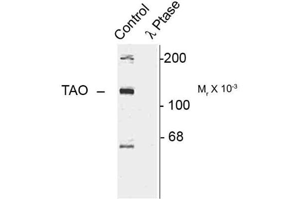 TAO Kinase 2 antibody  (pSer181)