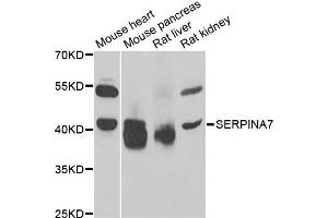 Western blot analysis of extracts of various cell lines, using SERPINA7 antibody. (SERPINA7 antibody)