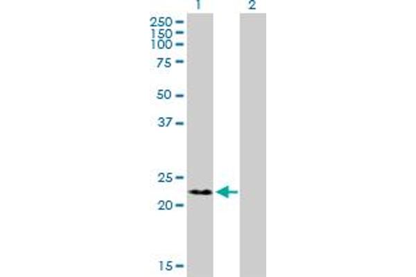 RNF166 antibody  (AA 1-237)