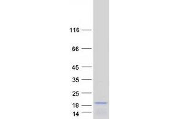 ASIP Protein (Myc-DYKDDDDK Tag)