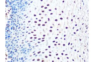 Immunohistochemistry of paraffin-embedded human esophageal using THOC4/THOC4/ALYREFREF Rabbit mAb (ABIN1679512, ABIN3018793, ABIN3018794 and ABIN7101662) at dilution of 1:100 (40x lens). (THO Complex 4 antibody)