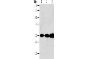 Western Blotting (WB) image for anti-Glutathione Reductase (GSR) antibody (ABIN2421640) (Glutathione Reductase antibody)