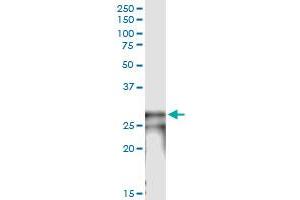 Immunoprecipitation of NOG transfected lysate using anti-NOG MaxPab rabbit polyclonal antibody and Protein A Magnetic Bead , and immunoblotted with NOG purified MaxPab mouse polyclonal antibody (B01P) . (NOG antibody  (AA 1-232))