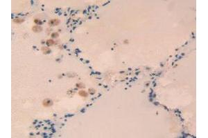 IHC-P analysis of Human Lung Tissue, with DAB staining. (RORC antibody  (AA 212-461))