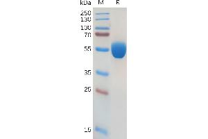 Human GM-CSF Protein, hFc Tag on SDS-PAGE under reducing condition. (GM-CSF Protein (AA 18-144) (Fc Tag))
