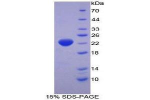 SDS-PAGE (SDS) image for Interferon, alpha 2 (IFNA2) (AA 24-188) protein (His tag) (ABIN2125373) (IFNA2 Protein (AA 24-188) (His tag))