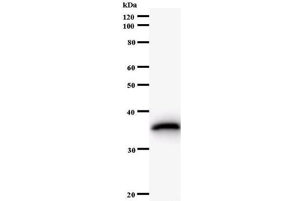 NAB1 antibody