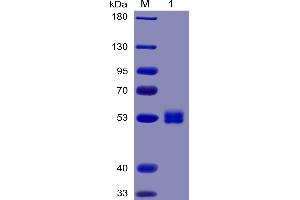 Human IL6 Protein, mFc-His Tag on SDS-PAGE under reducing condition. (IL-6 Protein (AA 30-212) (mFc-His Tag))