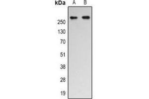 Western blot analysis of p300 (AcK1542) expression in Jurkat (A), Hela (B) whole cell lysates. (p300 antibody  (acLys1542))
