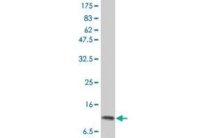 Western Blot detection against Immunogen (15. (IL-2 antibody  (AA 21-153))