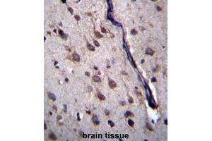 Immunohistochemistry (IHC) image for anti-Protein Phosphatase 1, Regulatory Subunit 27 (PPP1R27) antibody (ABIN2997187) (PPP1R27 antibody)