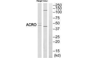 Western blot analysis of extracts from HEPG2 cells and COLO cells, using ACRO (heavy chain, Cleaved-Ile43) antibody. (Acrosin antibody  (Cleaved-Ile43, N-Term))