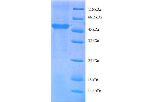 RPS9 Protein (AA 2-184, partial) (GST tag)