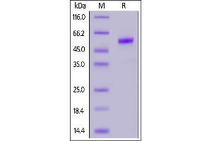 Human PLGF (19-149), Fc Tag on  under reducing (R) condition. (PLGF Protein (AA 19-149) (Fc Tag))