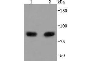 Lane 1: MCF-7, Lane 2: Raji lysate probed with PI 3 Kinase p85 alpha (2G4) Monoclonal Antibody  at 1:1000 overnight at 4˚C. (PIK3R1 antibody)