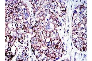 Immunohistochemistry (IHC) image for anti-Apoptosis-Inducing Factor, Mitochondrion-Associated, 1 (AIFM1) antibody (ABIN968950)