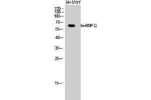 Western Blotting (WB) image for anti-Synaptotagmin Binding, Cytoplasmic RNA Interacting Protein (SYNCRIP) (Internal Region) antibody (ABIN3185069) (SYNCRIP antibody  (Internal Region))