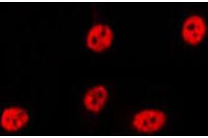 ABIN6269236 staining Hela by IF/ICC. (p21 antibody  (C-Term))