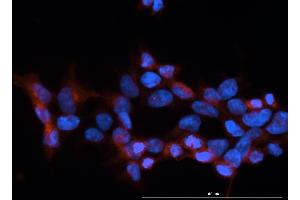 Immunofluorescence (IF) image for anti-IgG receptor FcRn (FcRn) antibody (ABIN1774762)