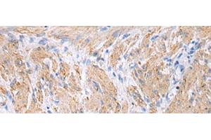 FBXO45 antibody