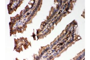 IHC testing of FFPE mouse intestine with HLA-C antibody. (HLA-C antibody)