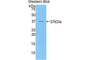 Western blot analysis of the recombinant protein. (PRAME antibody  (AA 416-502))