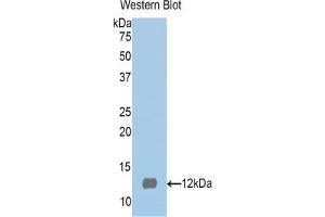 Western blot analysis of the recombinant protein. (S100 Protein (S100) (AA 2-94) antibody)