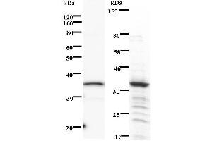 Left: PHF1 staining. (PHF1 antibody)