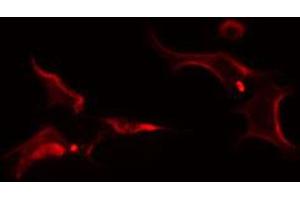 ABIN6274256 staining Hela cells by IF/ICC. (FRK antibody  (Internal Region))