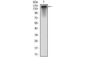 Western Blotting (WB) image for anti-MutS Homolog 6 (E. Coli) (MSH6) antibody (ABIN969293)