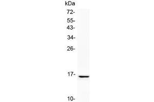 Western blot testing of human SK-OV-3 cell lysate with NPC2 antibody at 0. (NPC2 antibody)