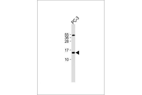 FUNDC2 antibody  (C-Term)
