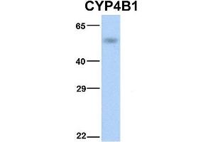 Western Blotting (WB) image for anti-Cytochrome P450, Family 4, Subfamily B, Polypeptide 1 (CYP4B1) (N-Term) antibody (ABIN2777006)