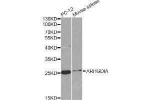 Western blot analysis of extracts of various cell lines, using ARHGDIA antibody. (ARHGDIA antibody)