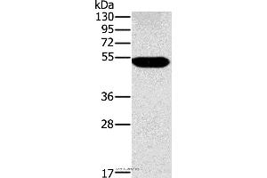 Western blot analysis of Human placenta tissue, using FUCA1 Polyclonal Antibody at dilution of 1:500 (FUCA1 antibody)