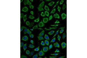 Immunofluorescence analysis of L929 cells using Bcl-2 antibody (ABIN7265812) at dilution of 1:100. (Bcl-2 antibody  (AA 1-100))