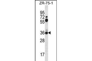 STX2 Antibody (Center) (ABIN656401 and ABIN2845695) western blot analysis in ZR-75-1 cell line lysates (35 μg/lane). (STX2 antibody  (AA 123-152))