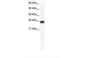 Image no. 1 for anti-Myogenic Factor 6 (MYF6) (AA 66-115) antibody (ABIN6735892) (MYF6 antibody  (AA 66-115))