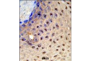 Immunohistochemistry (IHC) image for anti-Paired Box 3 (PAX3) antibody (ABIN3001734) (Paired Box 3 antibody)