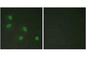 Immunofluorescence analysis of HeLa cells, using PPAR-BP (Phospho-Thr1457) Antibody. (PPAR-BP (AA 1423-1472), (pThr1457) antibody)