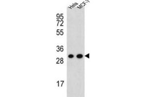 Western Blotting (WB) image for anti-Cytochrome C1 (CYC1) antibody (ABIN3002307) (Cytochrome C1 antibody)