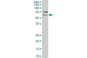 MAP3K2 polyclonal antibody (A01), Lot # 051115JC01 Western Blot analysis of MAP3K2 expression in NIH/3T3 . (MAP3K2 antibody  (AA 111-200))