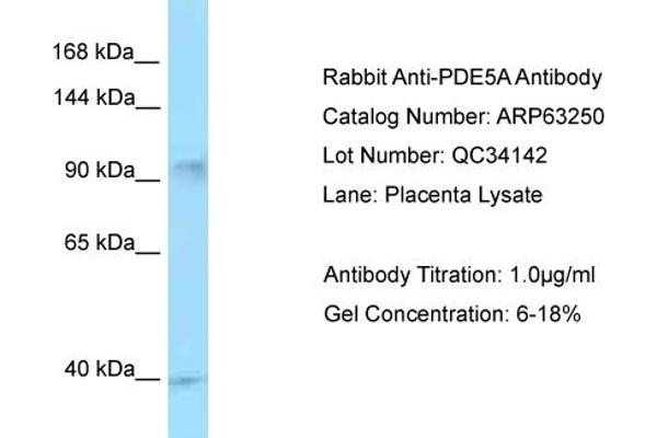 PDE5A antibody  (C-Term)