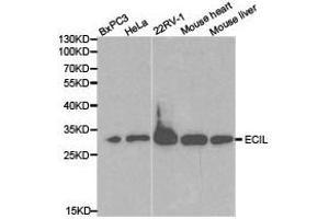 Western Blotting (WB) image for anti-Enoyl-CoA Delta Isomerase 1 (ECI1) antibody (ABIN1872411) (DCI antibody)