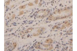 DAB staining on IHC-P; Samples: Human Stomach Tissue (AGR2 antibody  (AA 21-175))