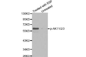 Western blot analysis of extracts from HepG2 cells untreated or treated with EGF using Phospho-AKT1/2/3-Y315/316/312 antibody (AKT 1/2/3 antibody  (pTyr312))