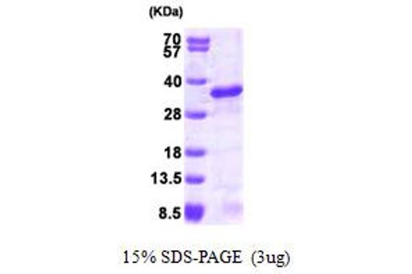 UBE2S Protein (AA 1-222) (His tag)