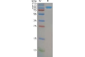 Human CD26 Protein, His Tag on SDS-PAGE under reducing condition. (DPP4 Protein (AA 29-766) (His tag))